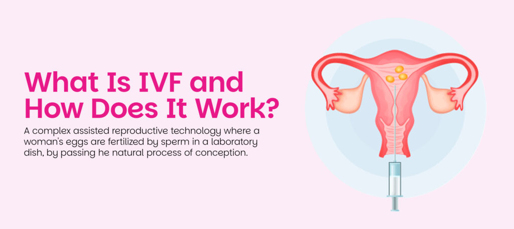 what is IVF and how it works for couples facing infertility.